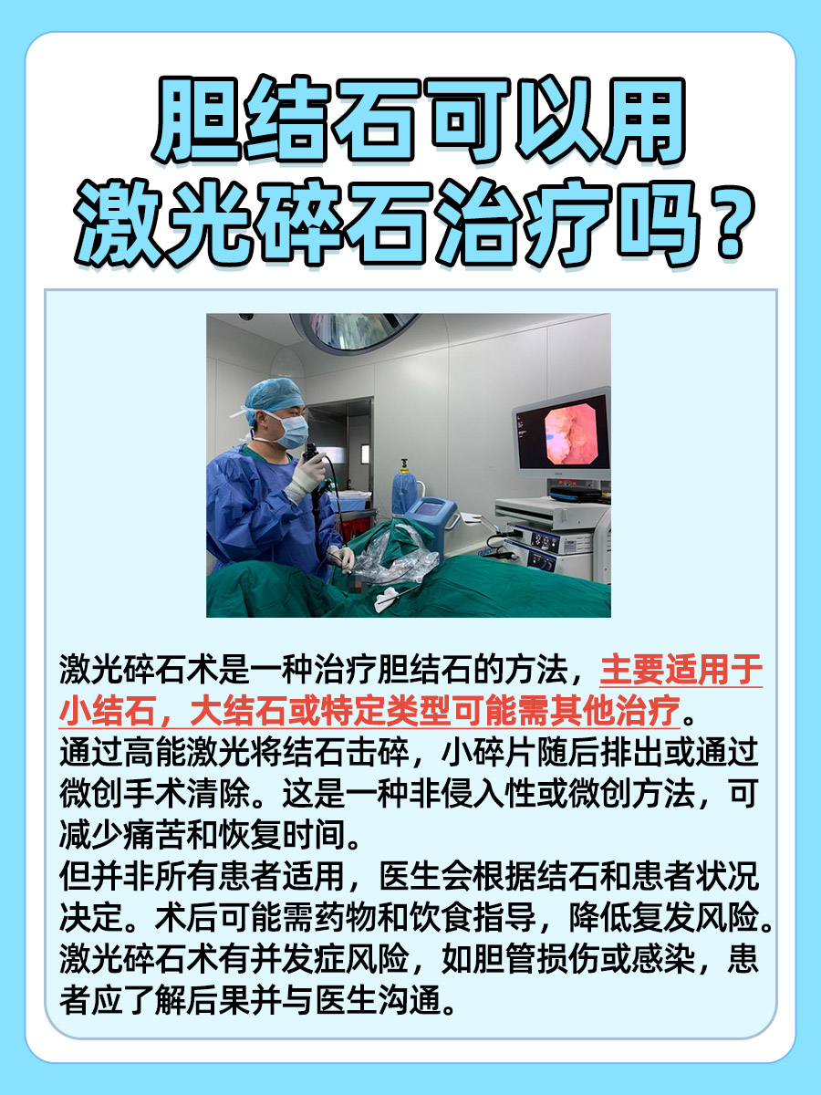 胆结石可以用激光碎石治疗吗？了解新技术