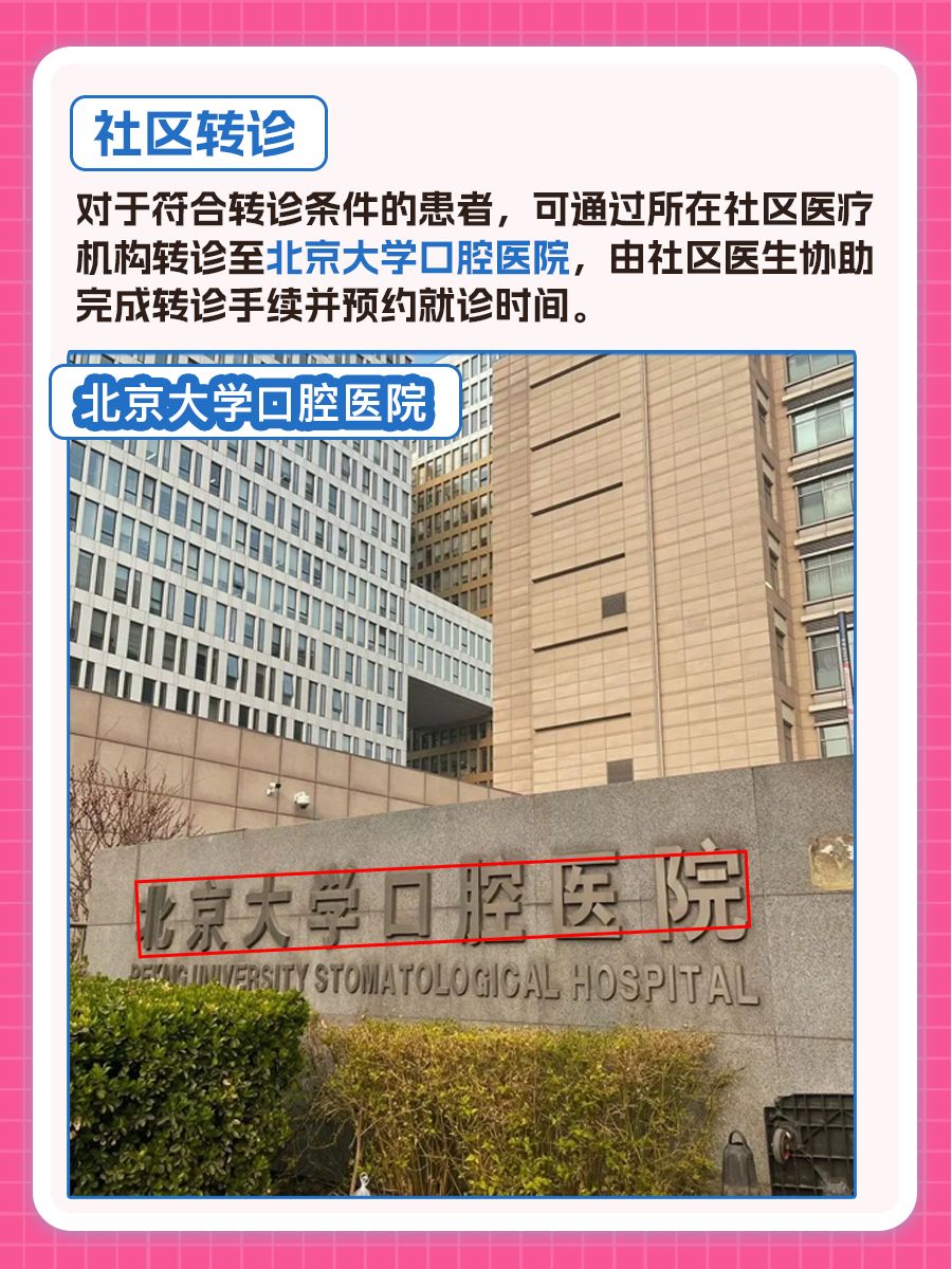 北京大学口腔医院张珊珊医生怎么样？怎么挂号？