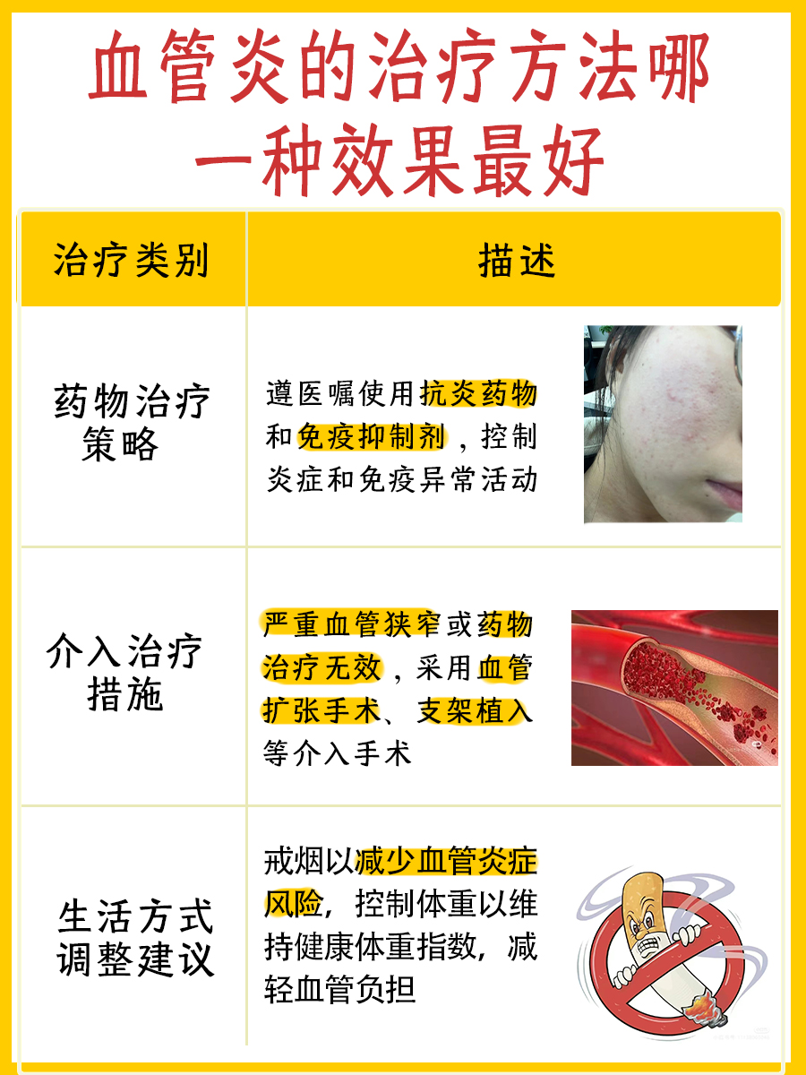血管炎的治疗方法：哪种措施效果好些？