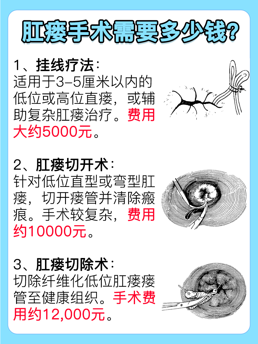 肛瘘手术大概需要多少钱？来了解一下