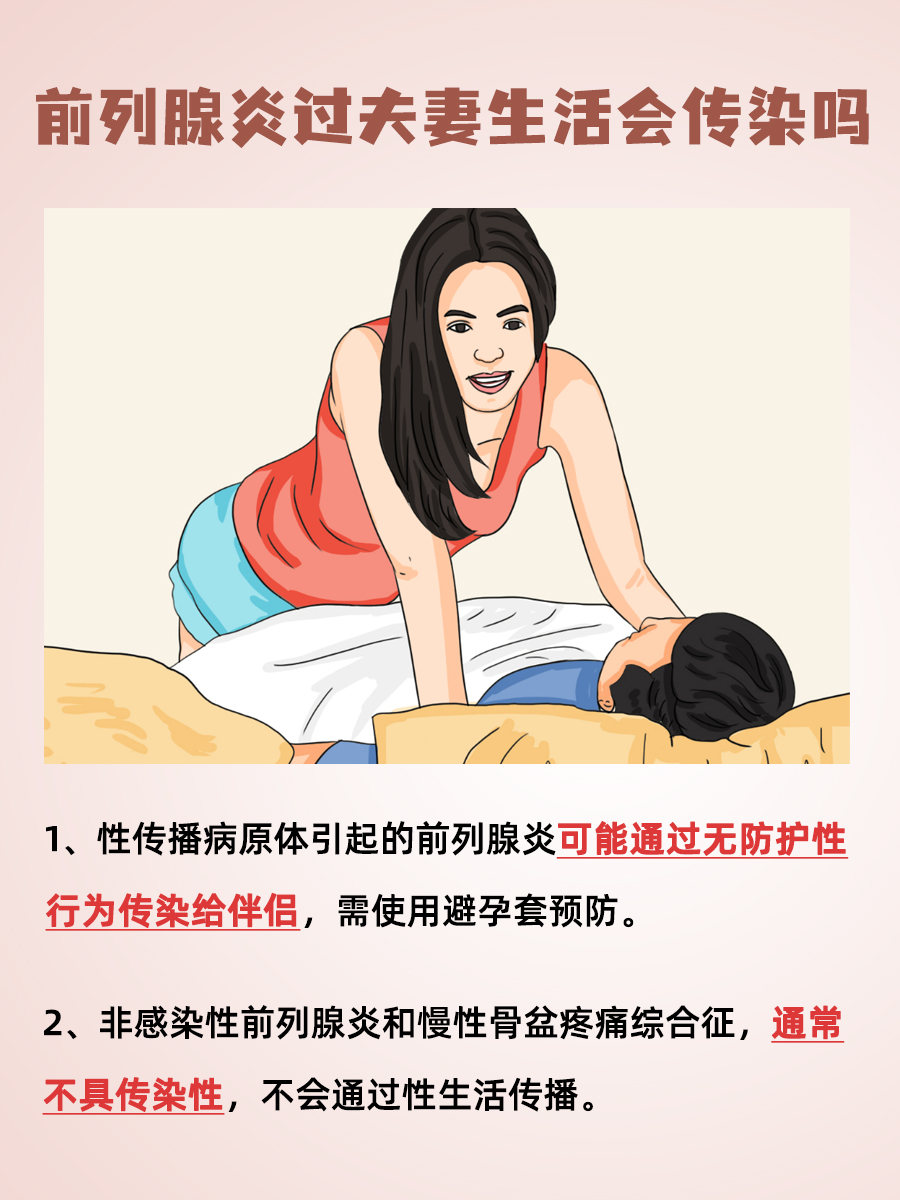 前列腺炎：是否会通过夫妻生活传染？