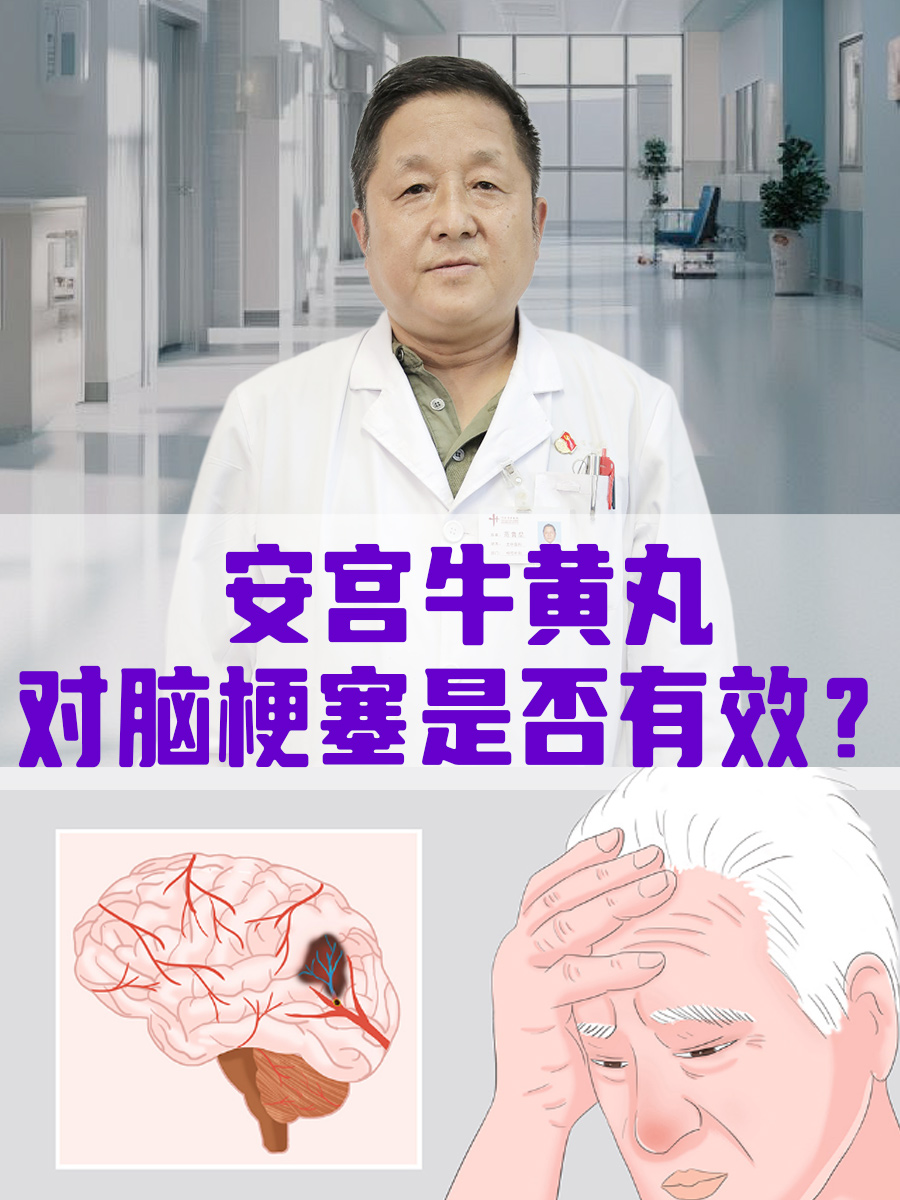 安宫牛黄丸：对脑梗塞是否有效？