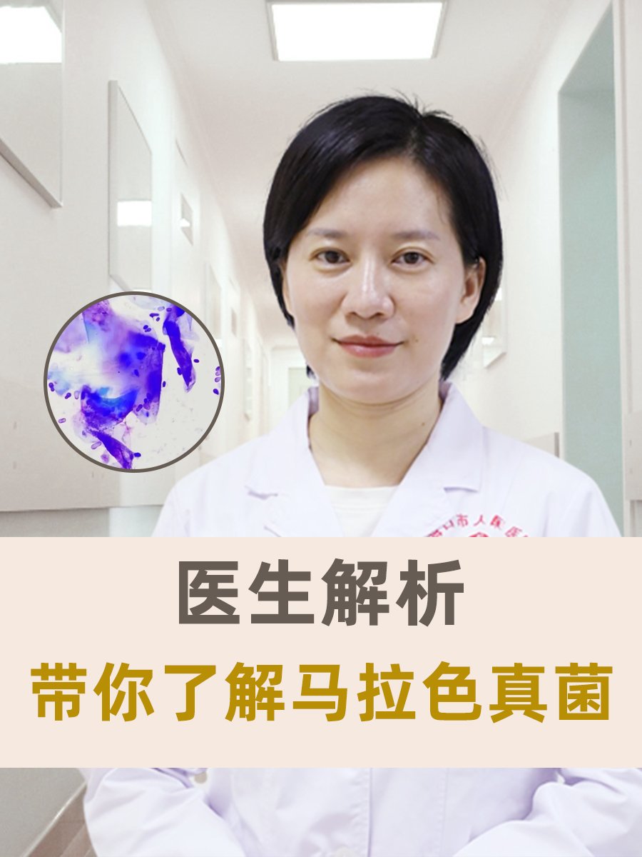 医生解析：带你了解马拉色真菌