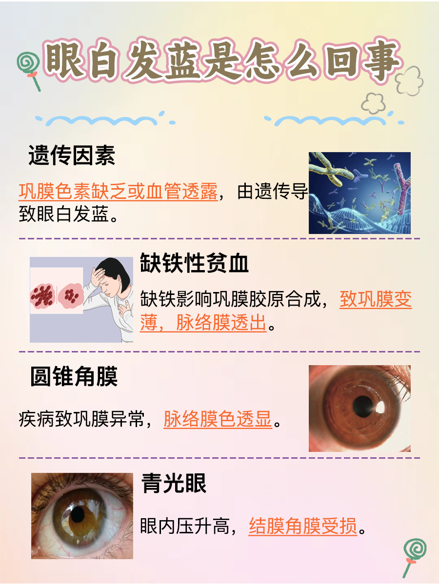 全面解析:眼白发蓝怎么回事?