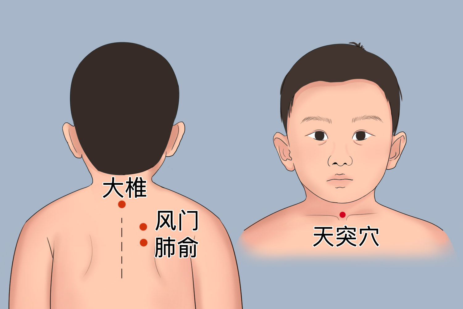 宝宝感冒贴所贴穴位图
