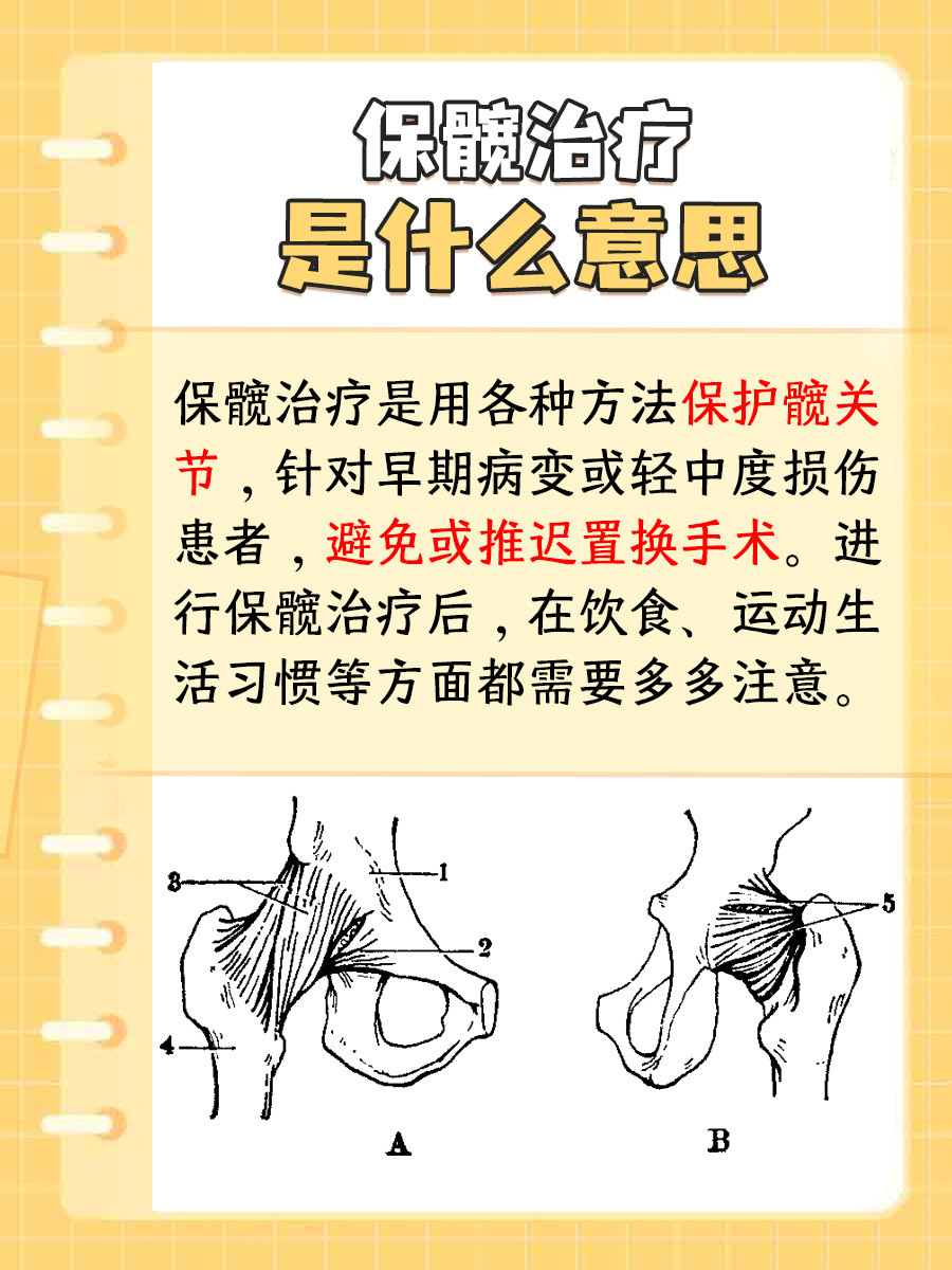 保髋治疗是什么意思，你知道吗