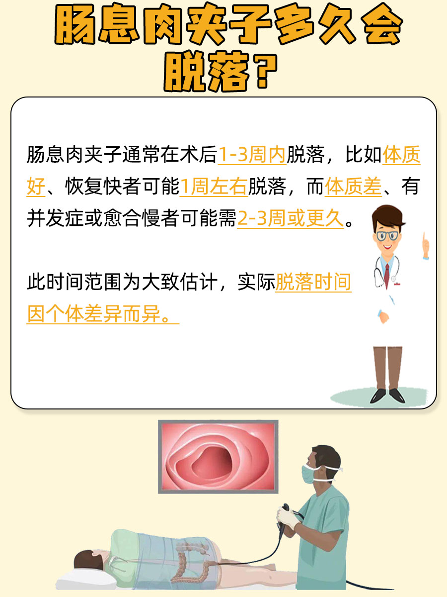 揭秘！肠息肉夹子多久会脱落？
