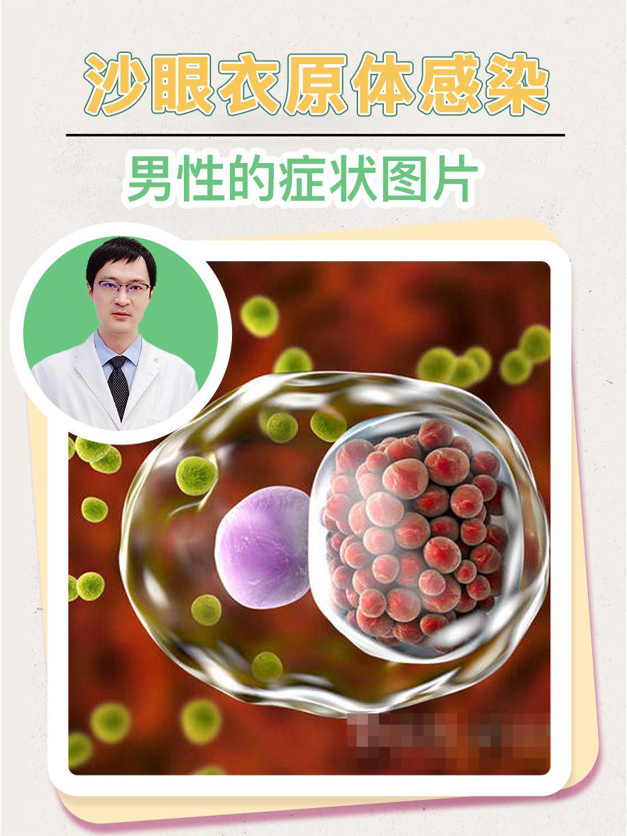 沙眼衣原体感染男性的症状图片