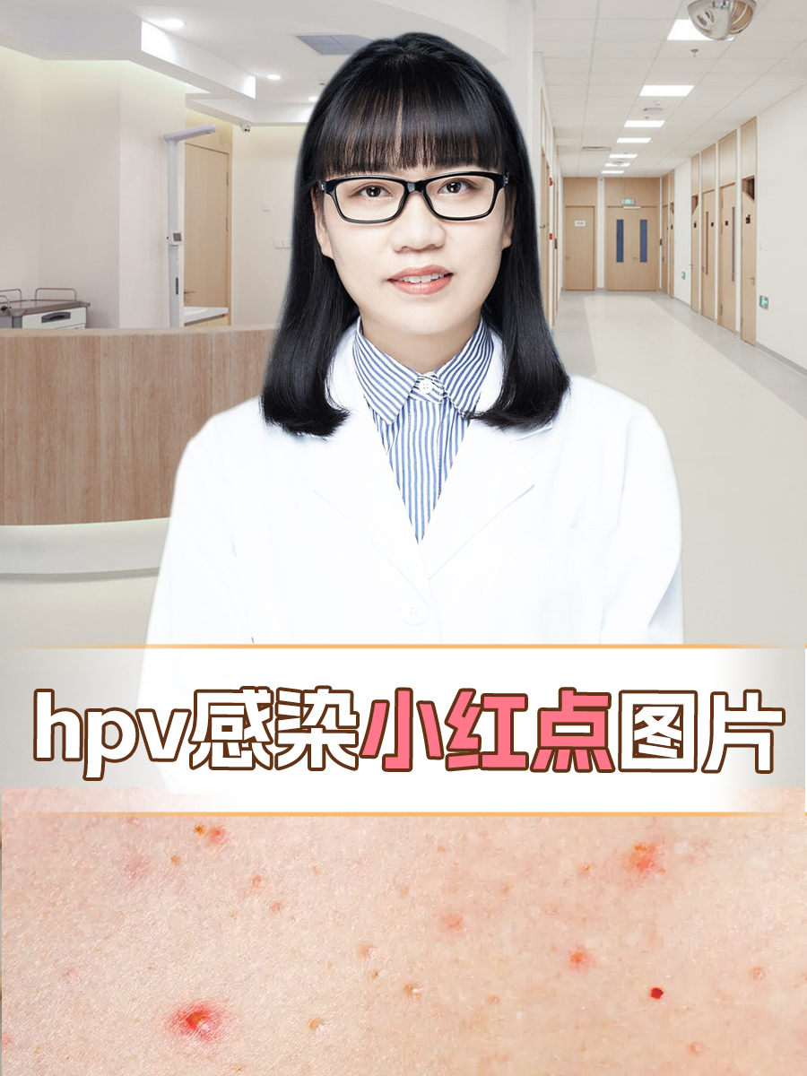 hpv感染小红点图片