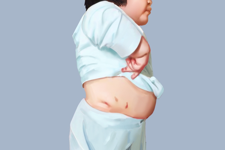 柯兴氏综合征悬垂腹图