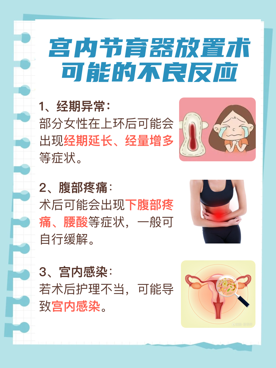 避孕选择经济账：上环手术费用全解析