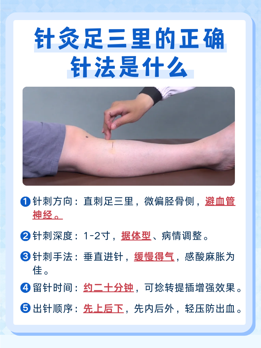 针灸足三里的正确针法：一文了解