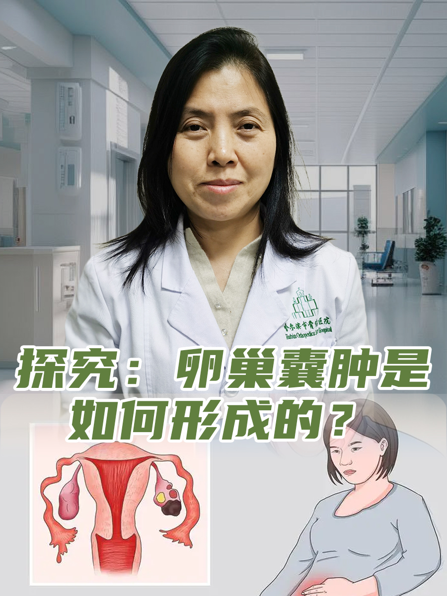 探究：卵巢囊肿是如何形成的？