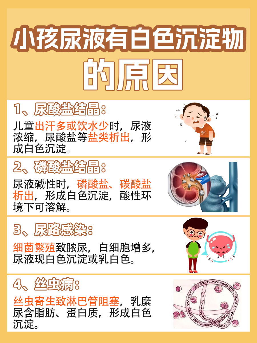 警惕!孩子尿液中有白色沉淀物可能是这些原因