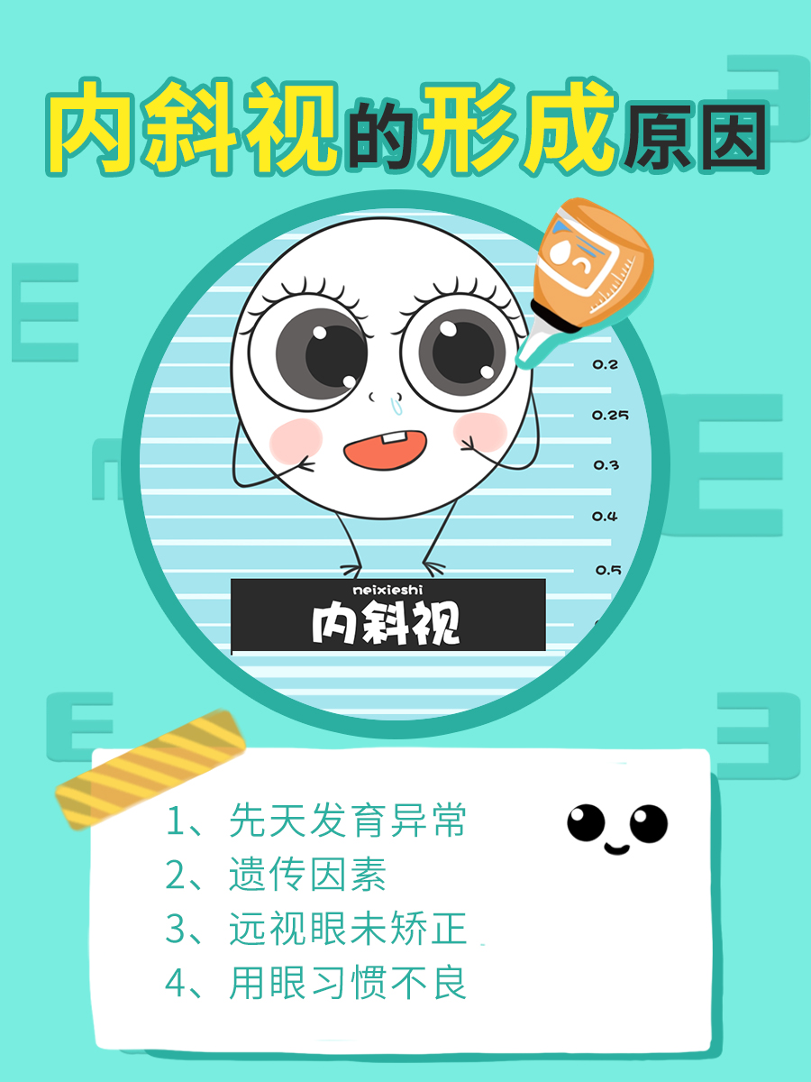 内斜视成因大起底，让你轻松get！