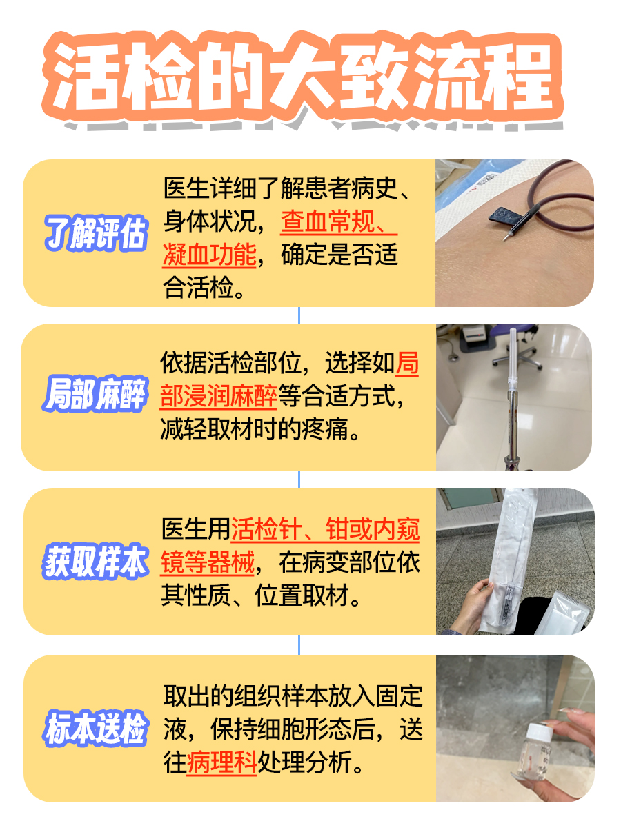 一文读懂活检：怎么做？要花多少钱？