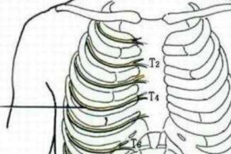 肋间神经痛部位图