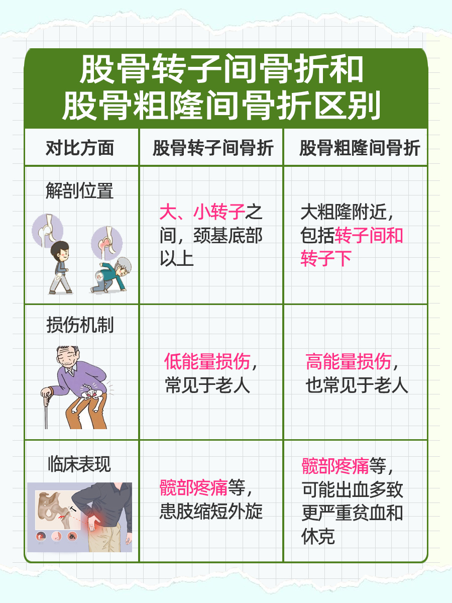 揭秘:股骨转子间骨折和股骨粗隆间骨折区别