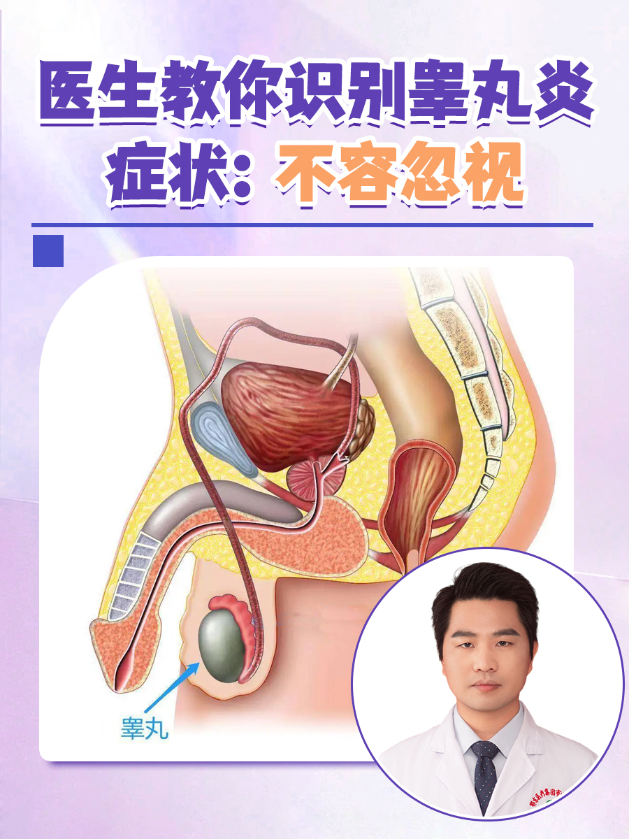医生教你识别睾丸炎症状：不容忽视