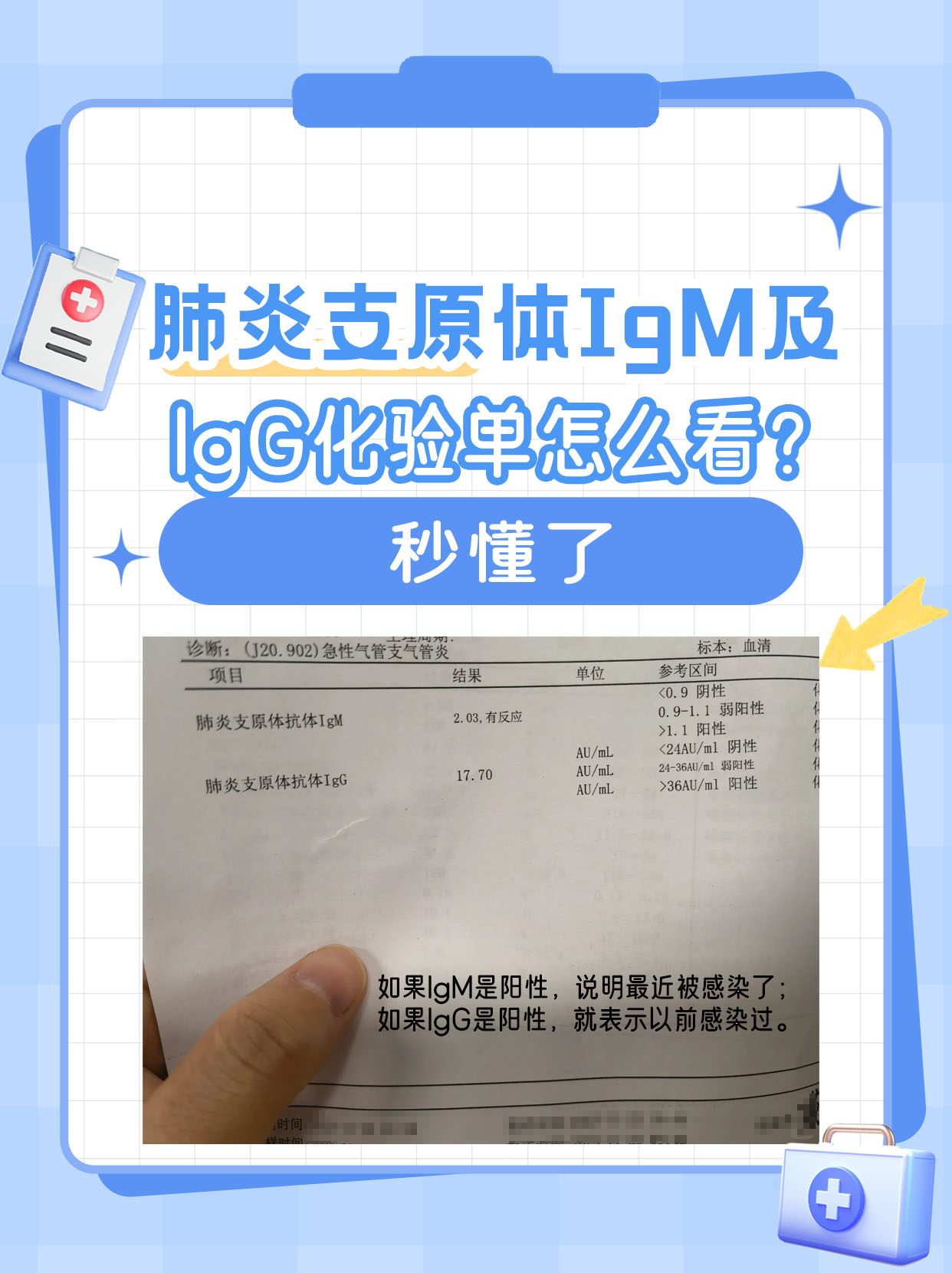 肺炎支原体IgM及IgG化验单怎么看?秒懂了