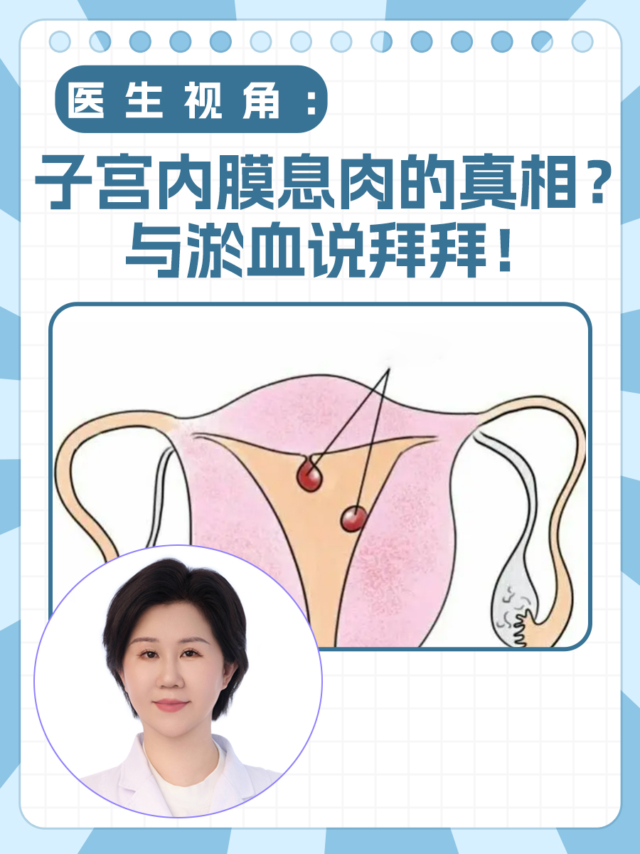 医生视角:子宫内膜息肉的真相?与淤血说拜拜!