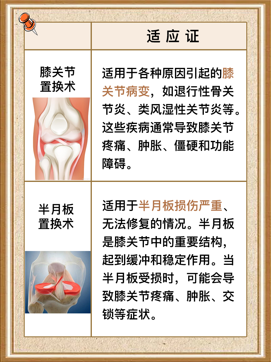 膝关节置换术和半月板置换术一样吗?别搞混啦