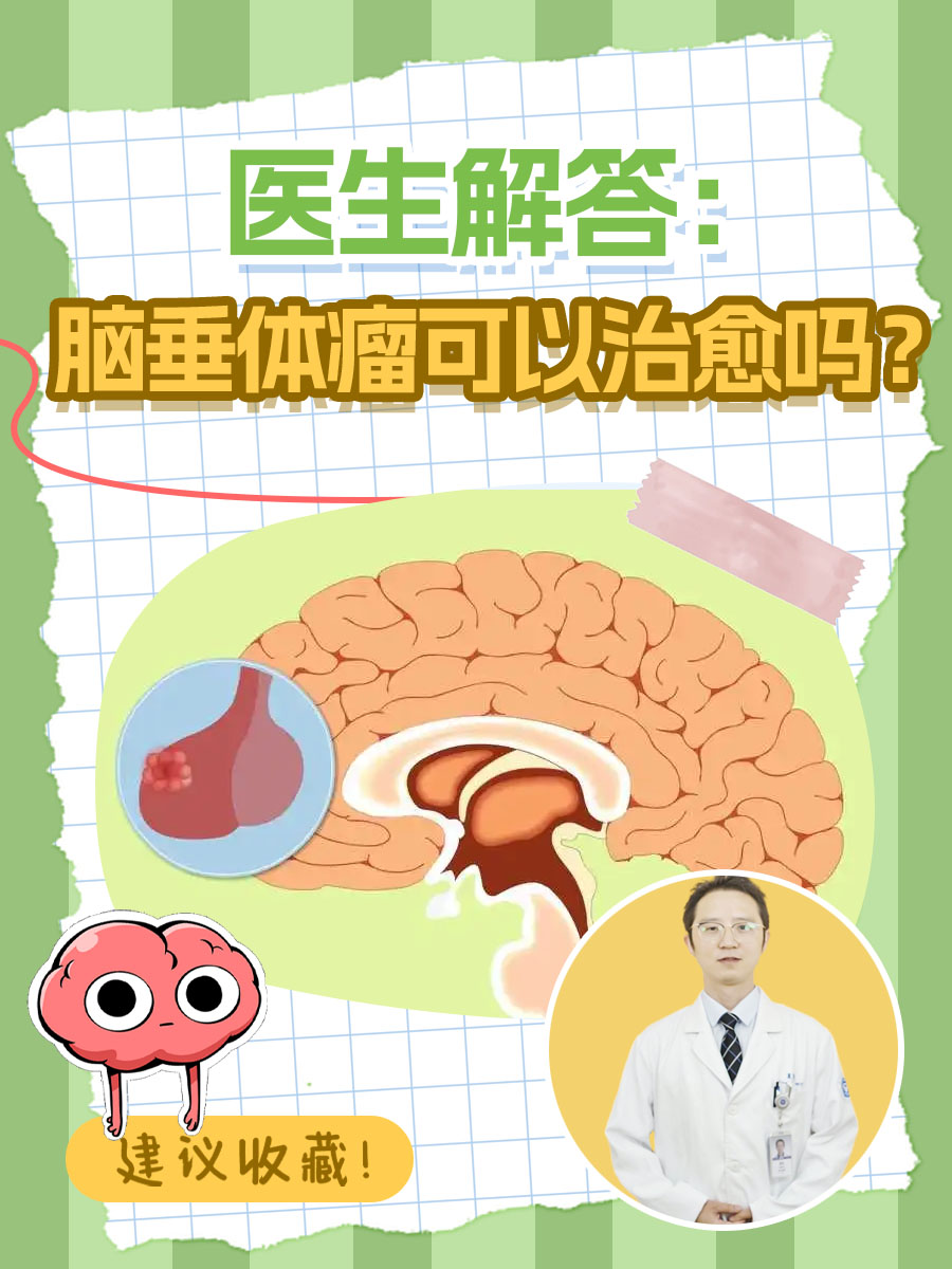 医生解答：脑垂体瘤可以治愈吗？