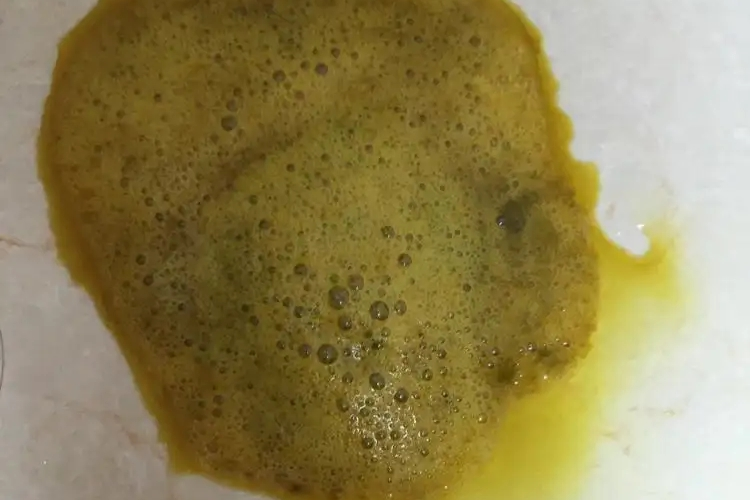 婴儿拉黄稀屎带泡沫图 婴儿拉黄稀屎带泡沫图