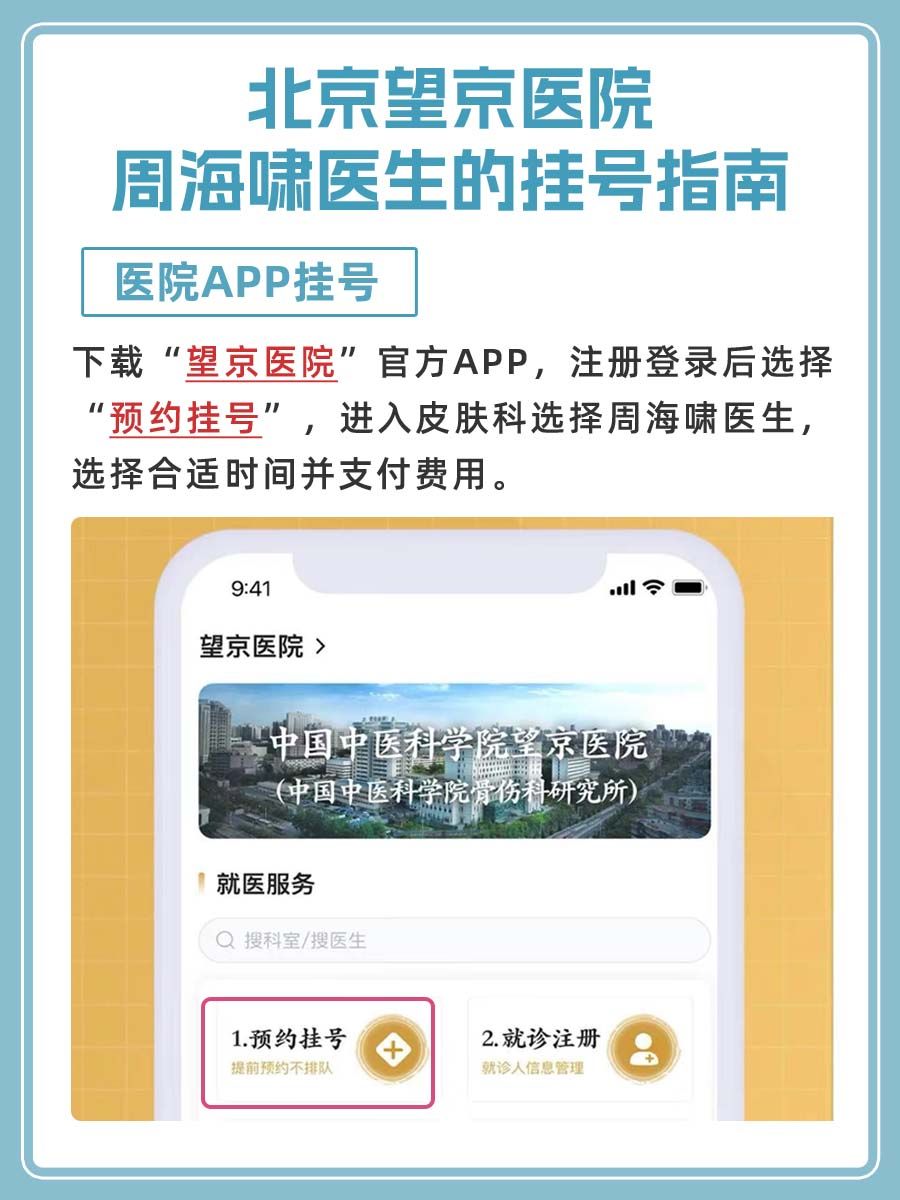北京望京医院周海啸医生怎么样？怎么挂号？
