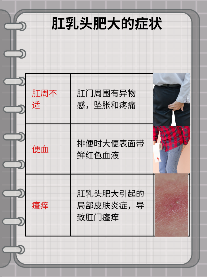 肛乳头肥大：症状识别与治疗方法解析