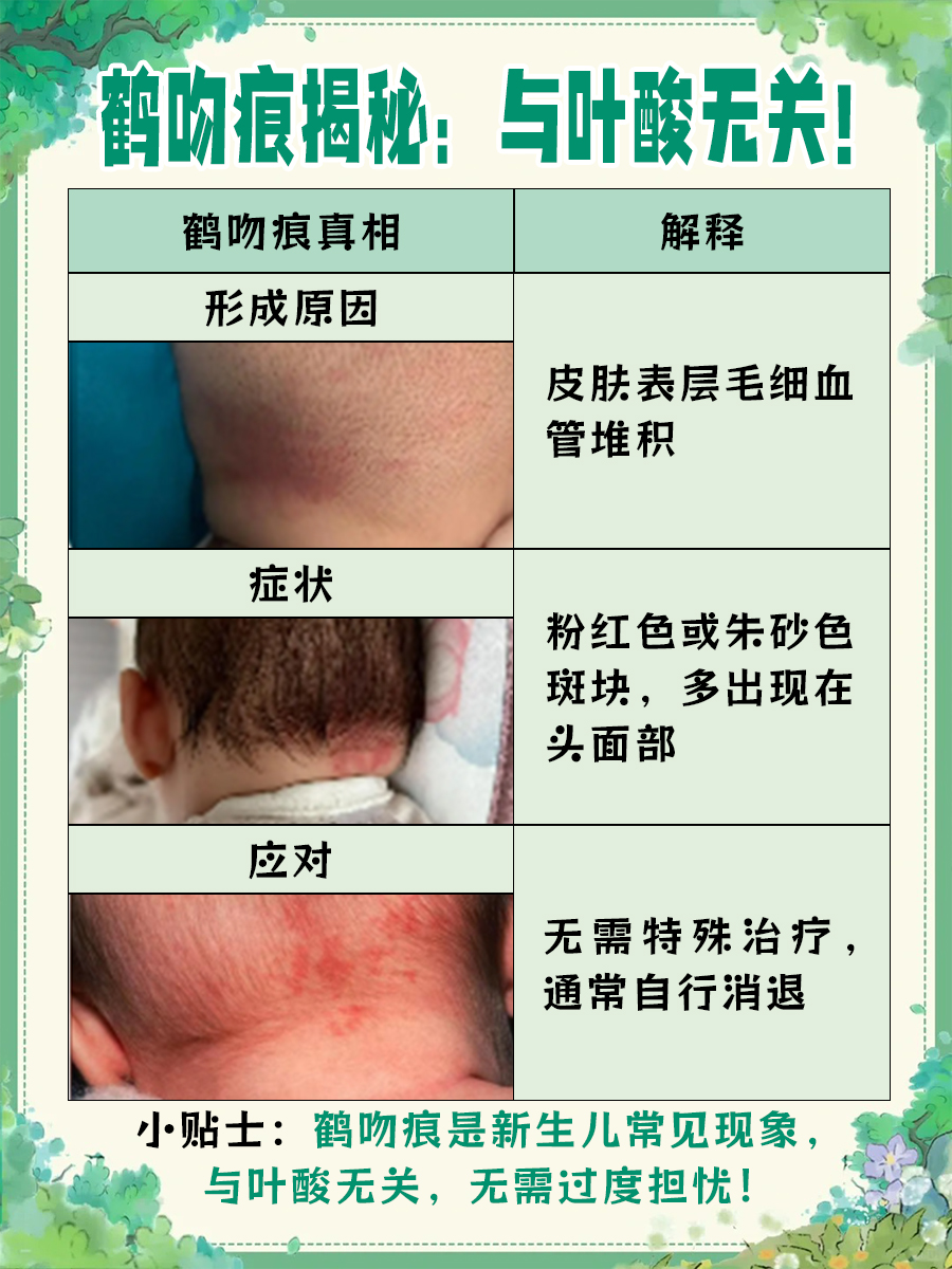 没补叶酸，宝宝就有“鹤吻痕”？真相在此！
