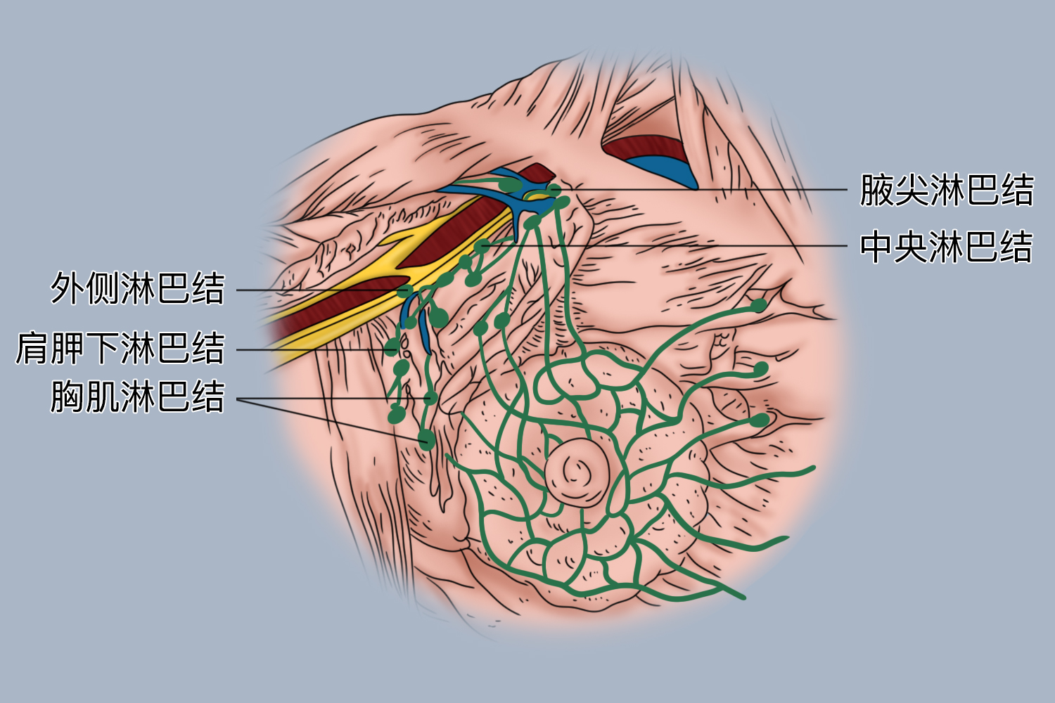 腋窝淋巴结图 腋窝淋巴结图
