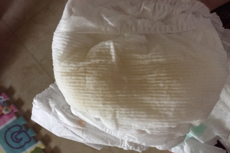 新生儿小便发黄图