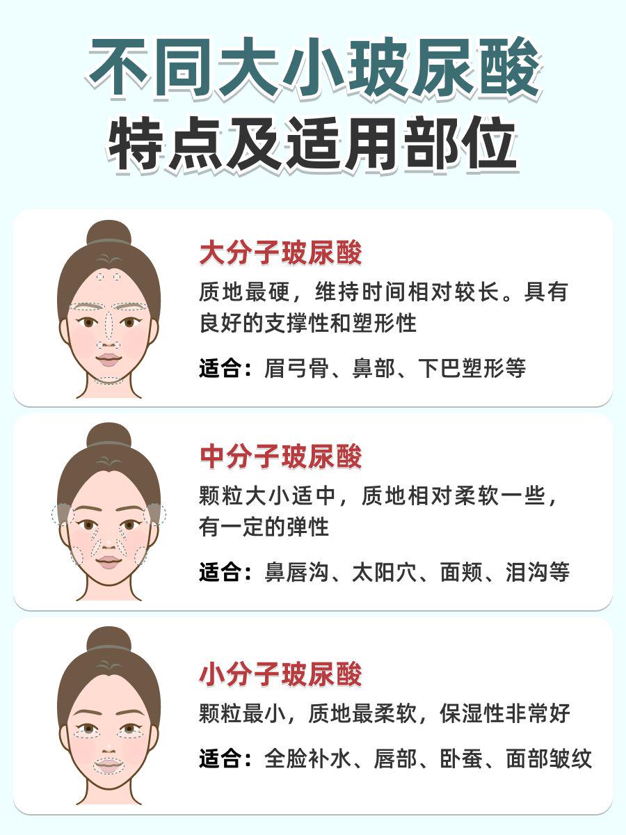 杭州玻尿酸攻略:让你明智选择,安全变美