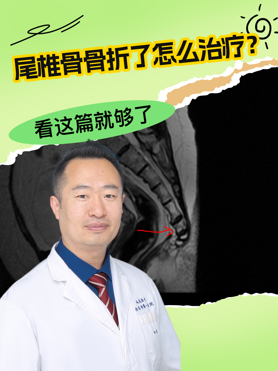 尾椎骨骨折了怎么治疗?看这篇就够了