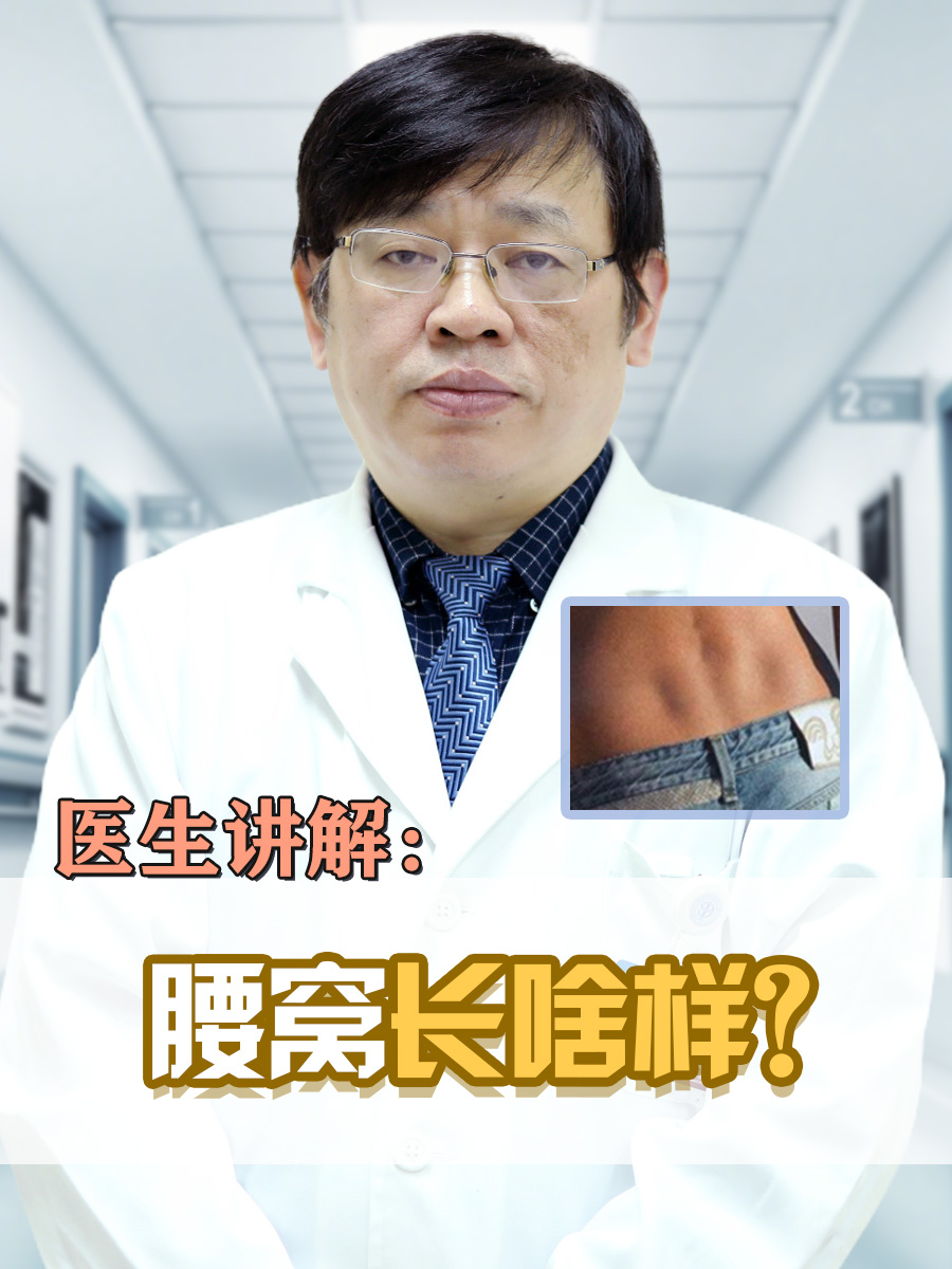 医生讲解：腰窝长啥样？（有图片参考）