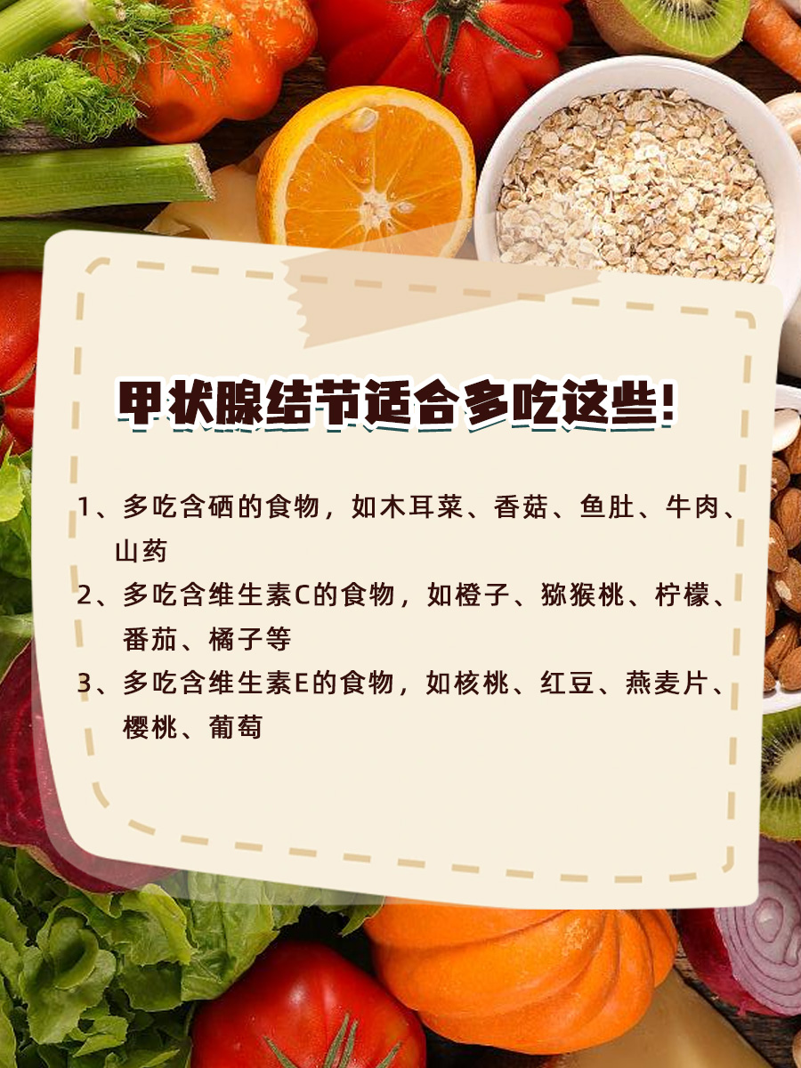 甲状腺结节3类：日常注意事项一网打尽