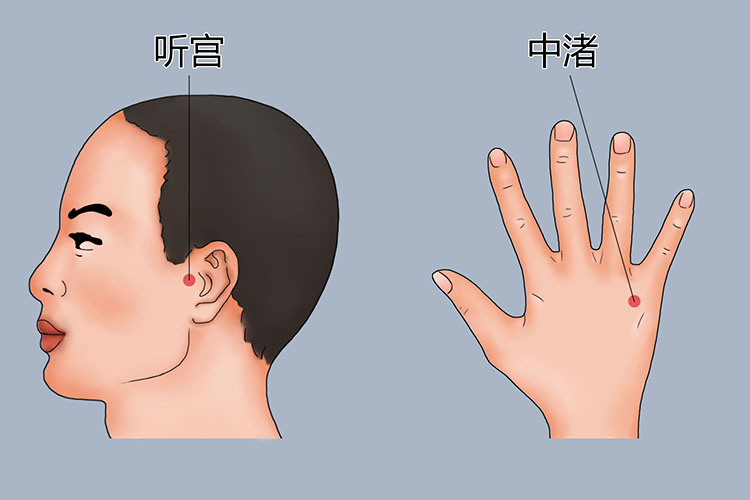 听宫穴、中渚穴位置图