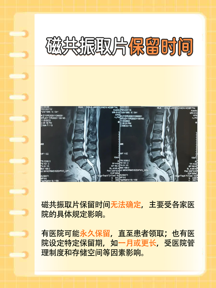 磁共振检查:取片保留时间