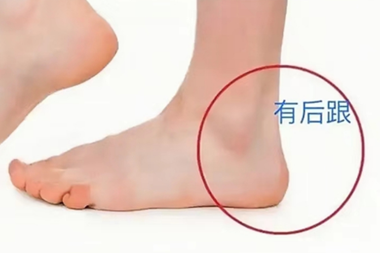 有脚后跟图