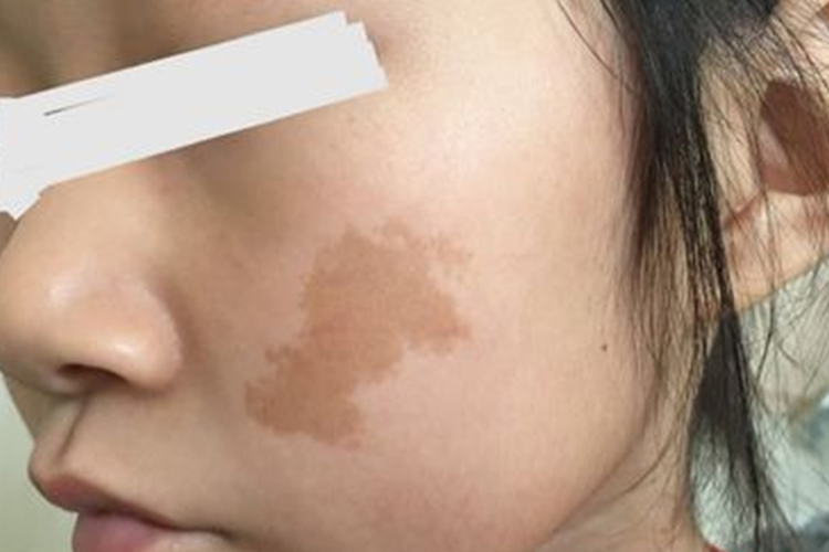 儿童咖啡牛奶斑图