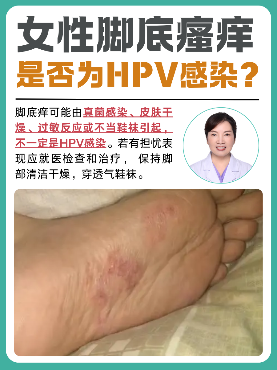 女性脚底瘙痒:是否为HPV感染?