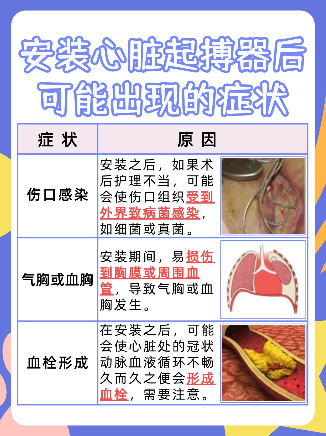 心跳新动力，起搏器的利弊全解析