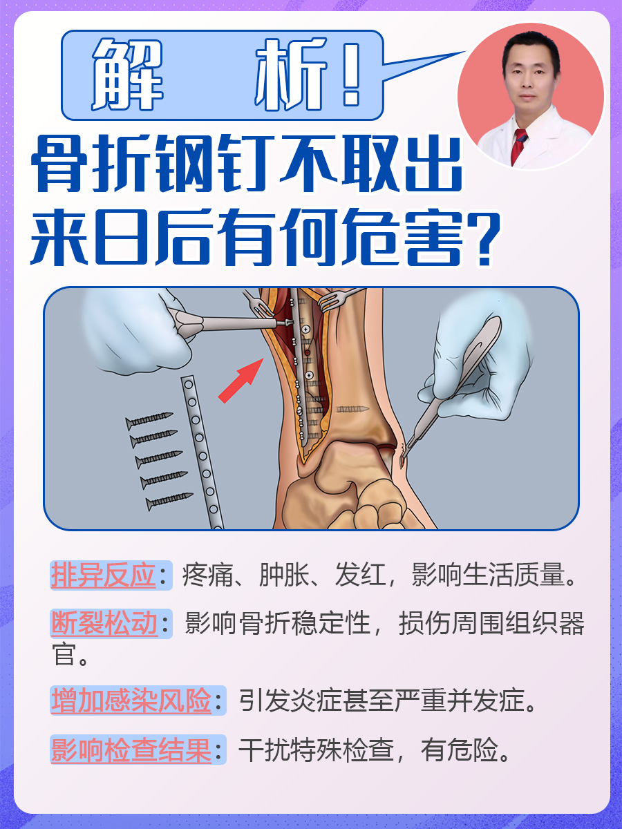 解析！骨折钢钉不取出来日后有何危害？