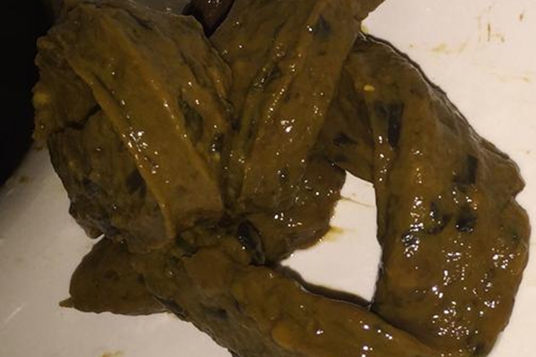 成人呕血棕色大便图