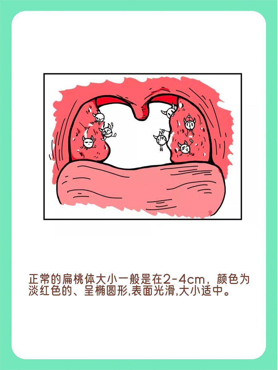 一图看懂扁桃体，了解它的大小、形状与功能