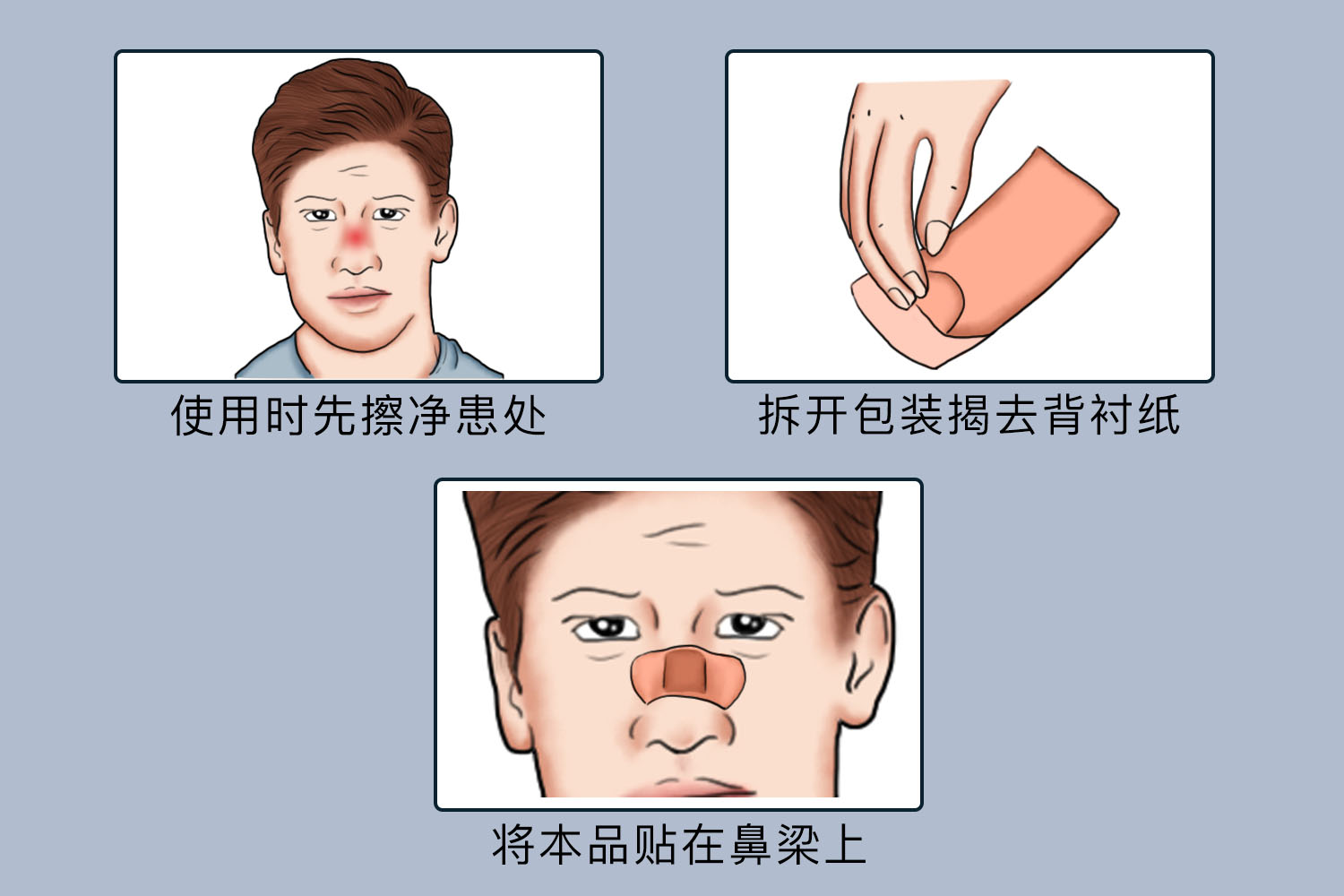 鼻炎贴使用方法图
