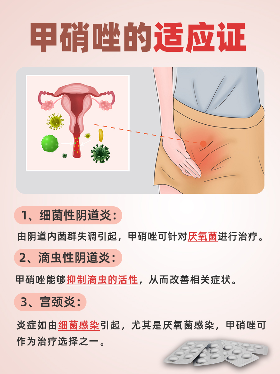 用药指南：妇科炎症甲硝唑的用法
