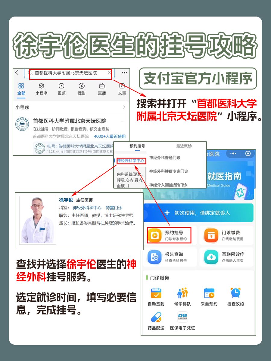 北京天坛医院徐宇伦医生怎么样?怎么挂号?