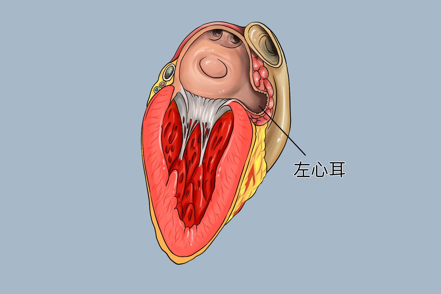 左心耳位置图